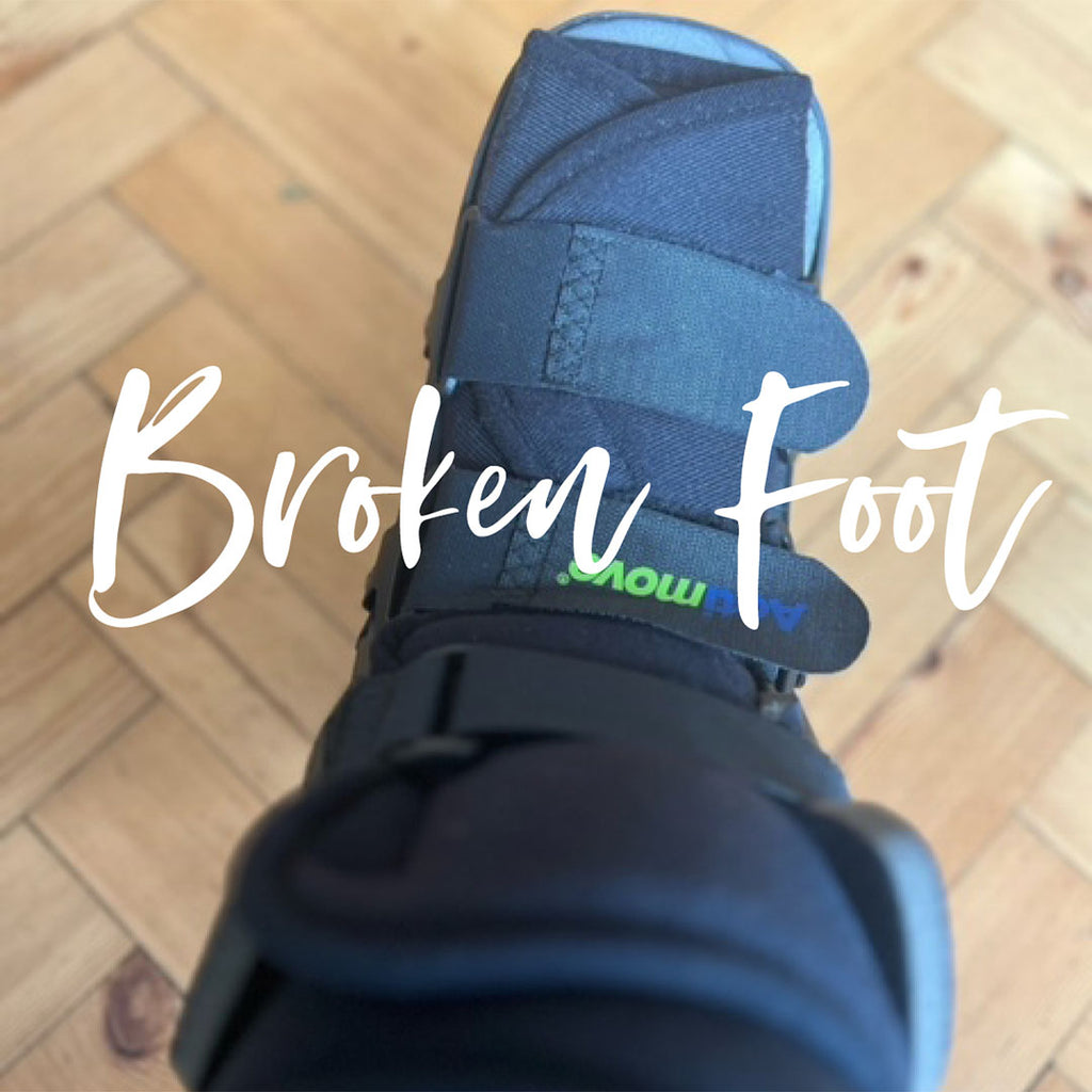 I Broke My Foot